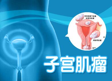 运城妇科医院
