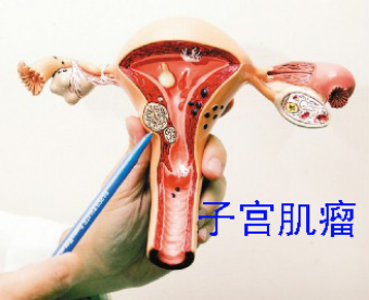 运城妇科医院
